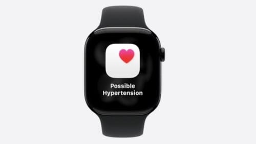 Apple Watch'un hipertansiyon bildirim özelliği nasıl çalışıyor?
