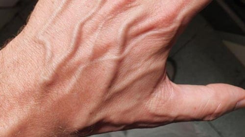 Kanın rengi kırmızıysa neden derideki damarlar yeşil veya mavi görünüyor?
