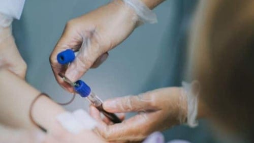 Bilim insanlarından büyük başarı: Kan kanseri tedavisi için yeni bir yöntem geliştirildi