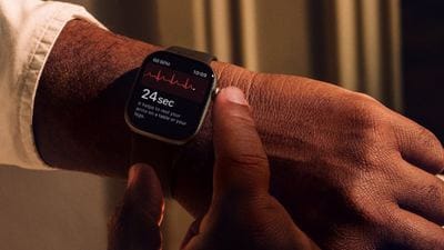 Apple’a kötü haber: Apple Watch için 818 milyon dolar ödeyecek